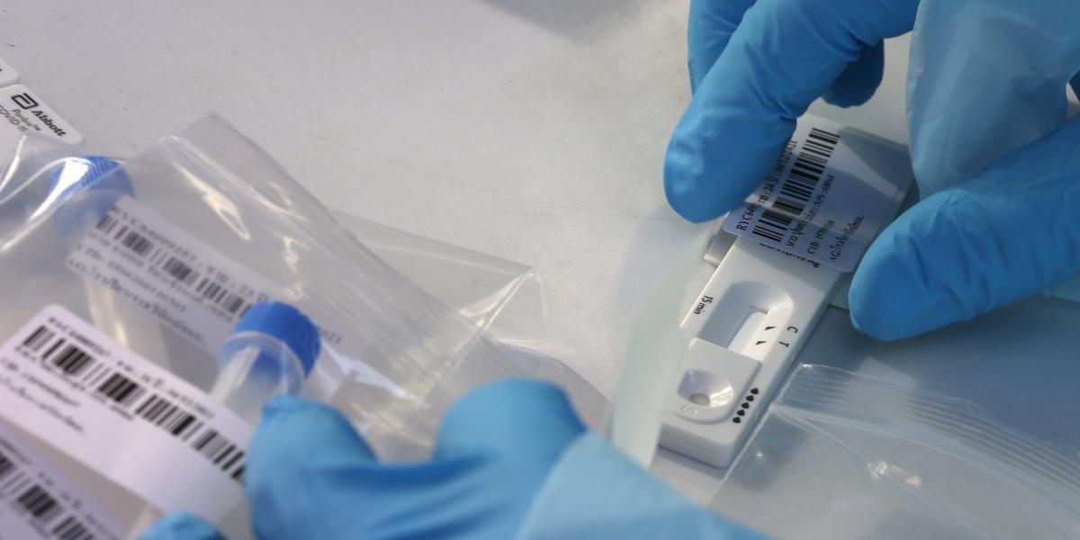 Algunos países alertan sobre la presencia de un nuevo tipo de coronavirus