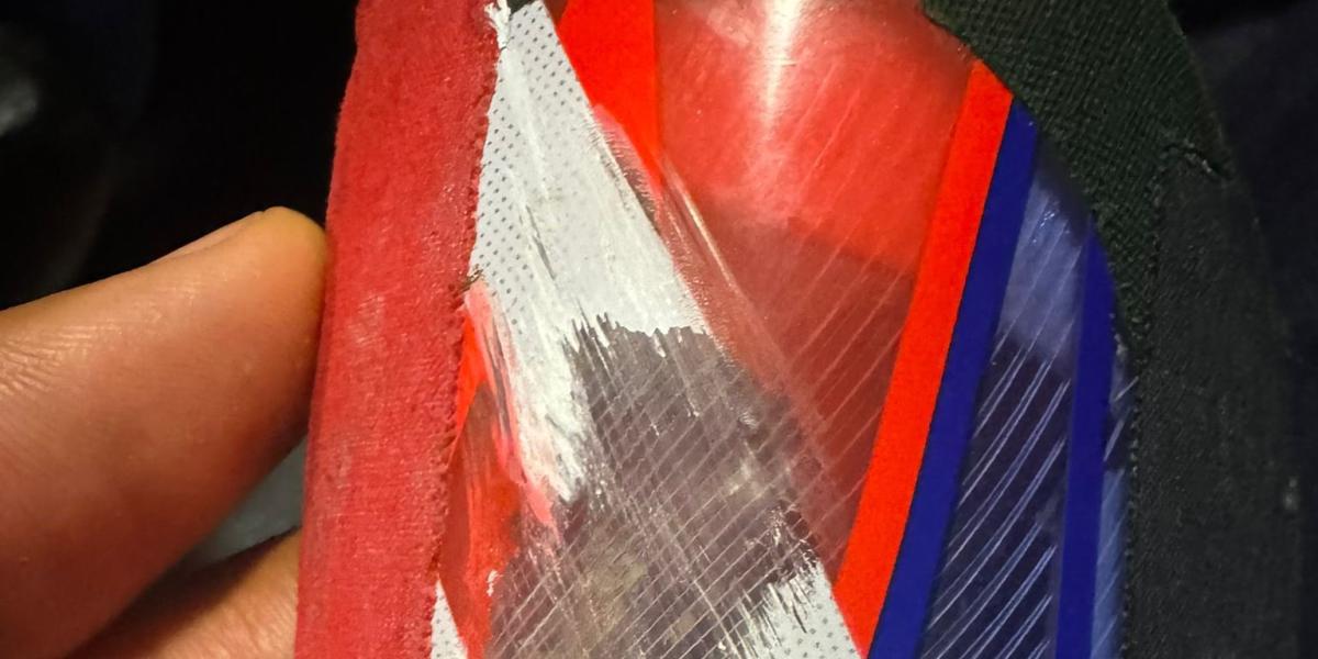 Así quedó la pierna de Reinildo tras salvar un gol con Mozambique