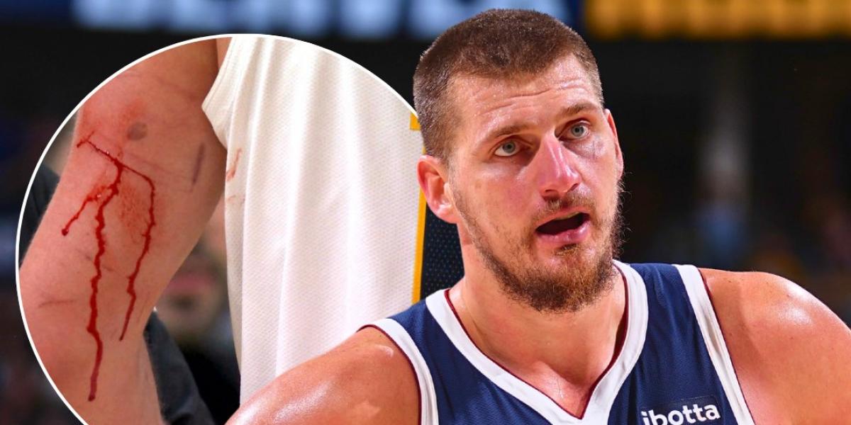 Jokic terminó con el brazo ensangrentado ante los Celtics