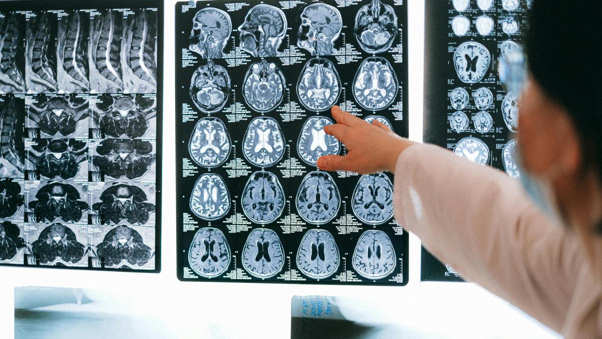 Un nuevo estudio sobre el cerebro que lo cambia todo: Podemos afirmar que el debate ha terminado